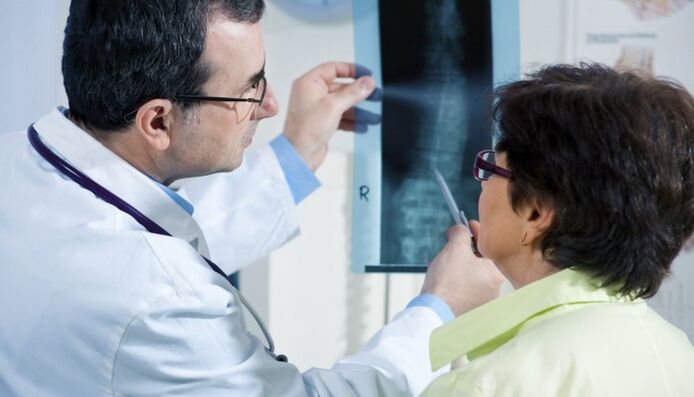 raio-x da coluna vertebral com osteocondrose