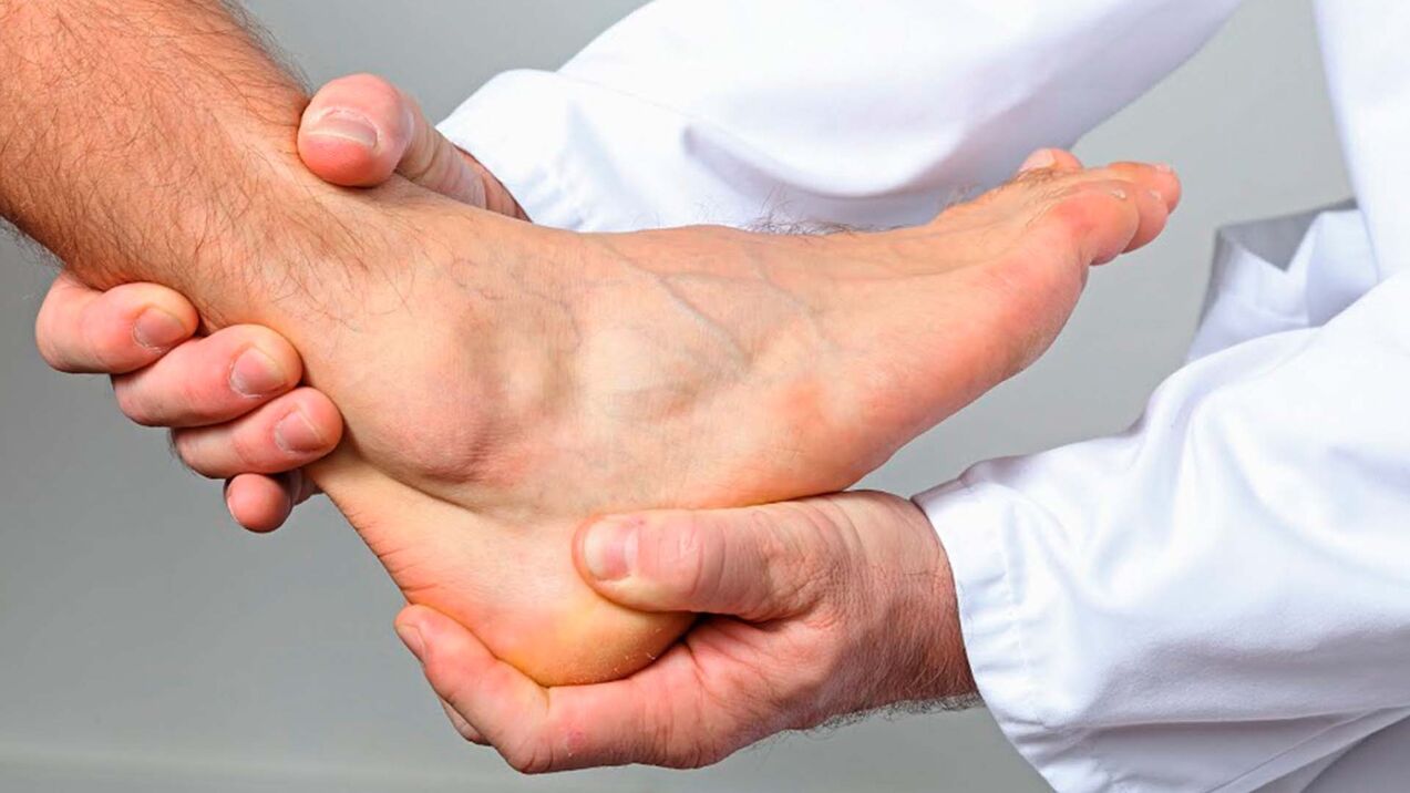 artrose da articulação do tornozelo