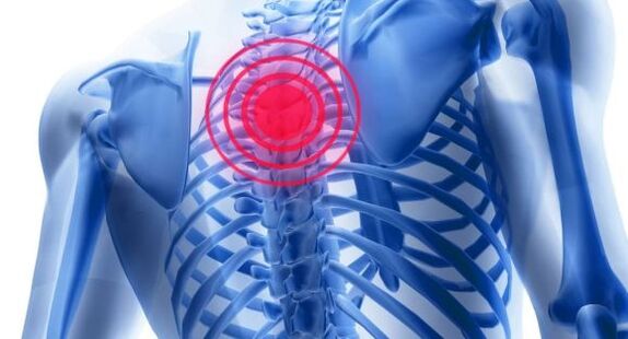 Tratamento da osteocondrose da coluna torácica