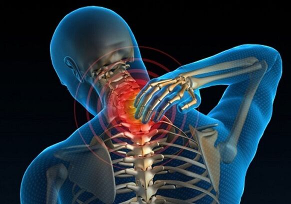 dor no pescoço devido à osteocondrose